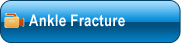 Ankle Fracture