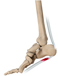 Foot Eversion