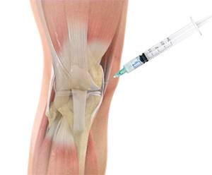 Knee Exam