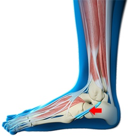 Foot Eversion