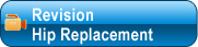 Revision Hip Replacement